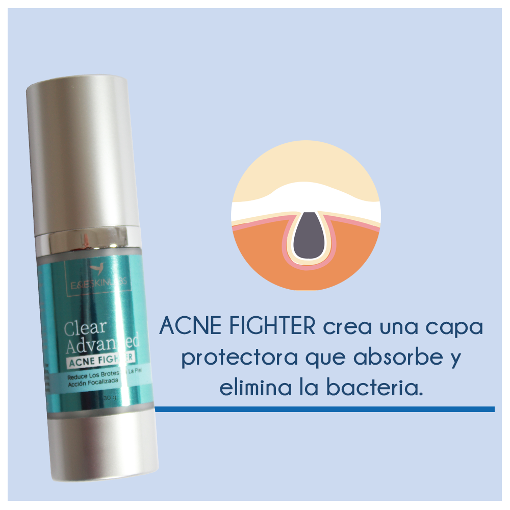 Crema Spot- Acne Fighter 30 g